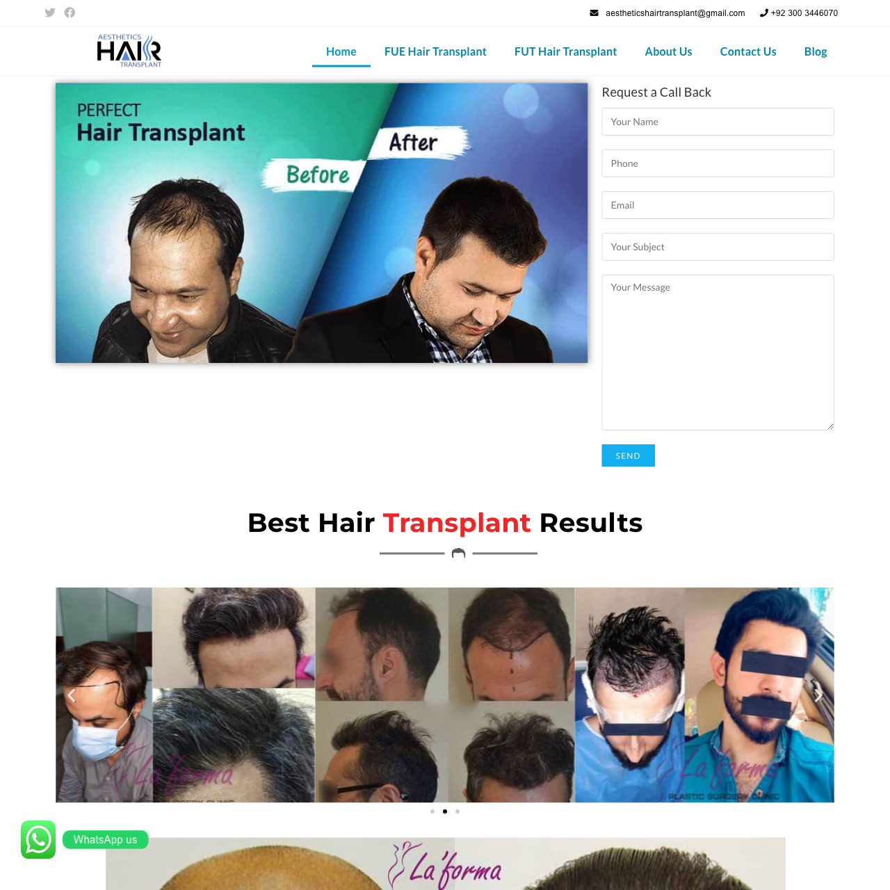 Aesthetics Hair Transplant